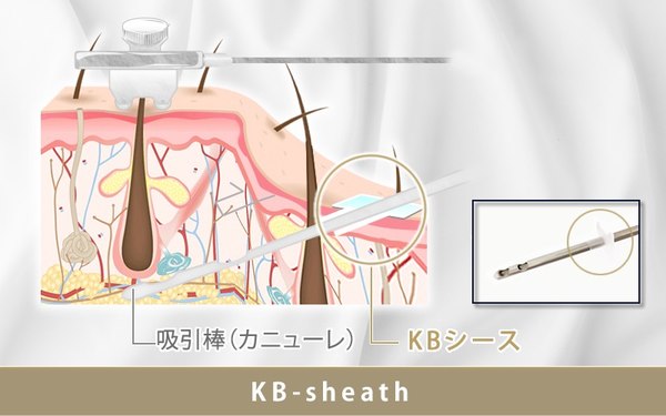 KB-sheath